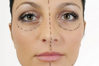 Beautyhelfer: Augenlifting ganz ohne OP