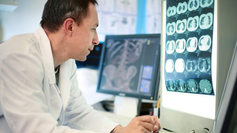 Arzt in weißem Kittel guckt sich Computer Tomographie - Bild an