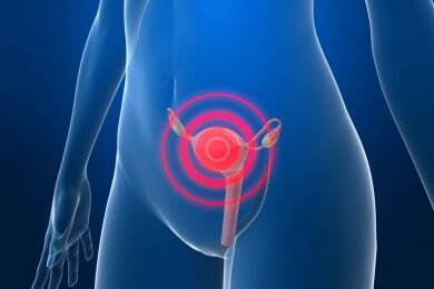Hochintensiver fokussierter Ultraschall zur narbenlosen Behandlung von Myomen