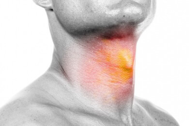 Gefährlicher Husten: Wiederkehrende Anfälle schädigen die Bronchien