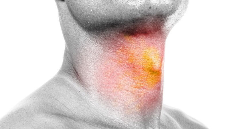 Schwarz-weiß Bild Männerhals, rot-gelb markiert - Halsschmerzen