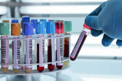 Die individualisierte Immuntherapie gegen Krebs macht Fortschritte