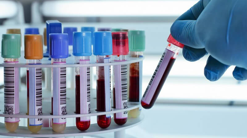 Mehrere Blutproben in Röhrchen zur Blutuntersuchung im Labor