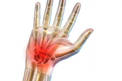 Karpaltunnelsyndrom & Co: Schmerzen in der Hand näher erklärt