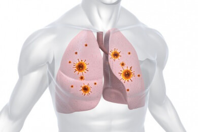 Lungenkrebs mit Resistenz bekommt neuen Gegenspieler