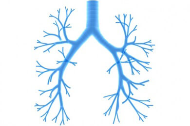 Tracheobronchomalazie beim Kleinkind: 3D-Drucker stellt Implantat her, das mitwächst