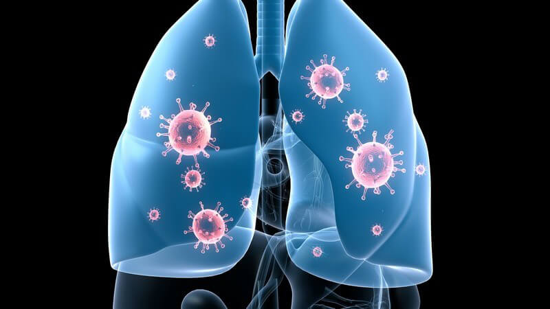 Grafik Lungeninfektion auf schwarzem Hintergrund