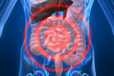 Morbus Crohn: Neben den Genen spielen die Bakterien im Darm eine Rolle