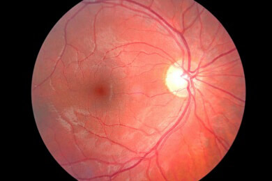 Hightech im Menschen: Neue Implantate für Gehirn und Augen