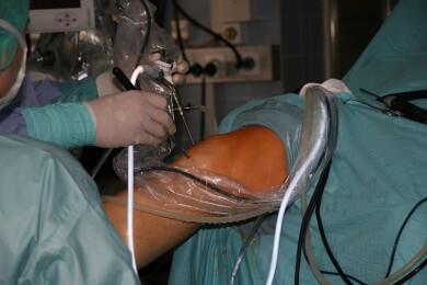 Überschätzte Therapie: Minimal-invasive Eingriffe im Knie bringen weniger als gedacht