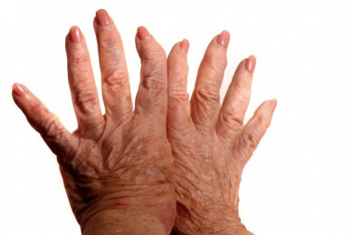 Fingerknacken muss der Gesundheit nicht schaden