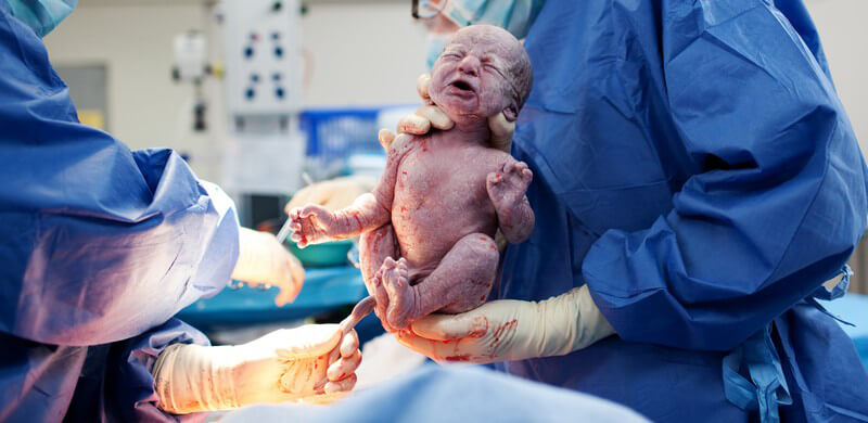 Geburt, Arzt hält Neugeborenes in Händen, Nabelschnur