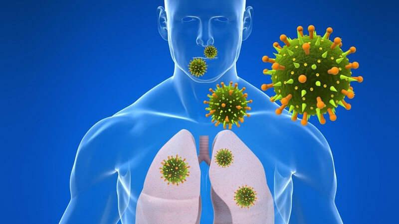 Grafik menschlicher Körper mit Lungeninfektion
