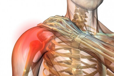 PC- und Smartphone-Schulter: die neuen Haltungsschäden unserer Zeit