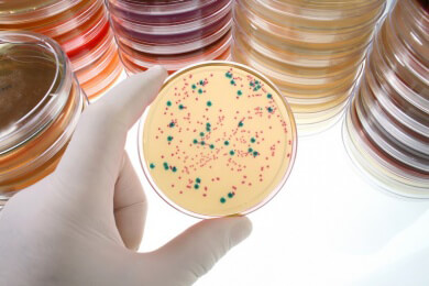 So wollen Wissenschaftler den gefährlichen Biofilm von Bakterien bekämpfen