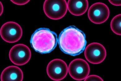 Akute myeloische Leukämie: Prognose verschlechtert sich durch bleibende Mutationen