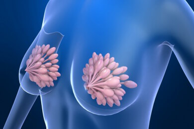 Gentest bei Brustkrebs erspart Patientinnen die Chemotherapie