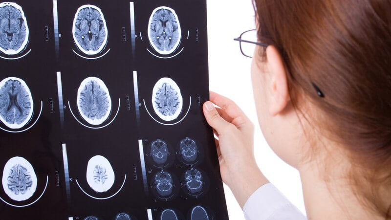 Ärztin mit Brille betrachtet Röntgenbilder des Gehirns