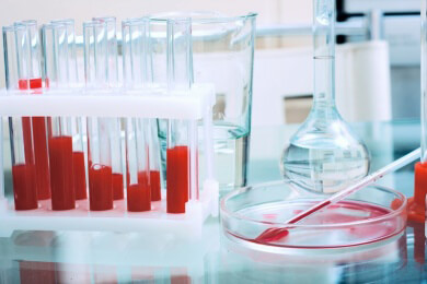 Sarkoidose schneller erkennen: Deutsche Forscher entwickeln verbesserte Diagnose