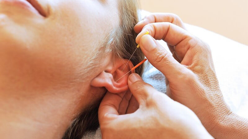 Junge Frau erhält eine Akupunkturbehandlung am linken Ohr