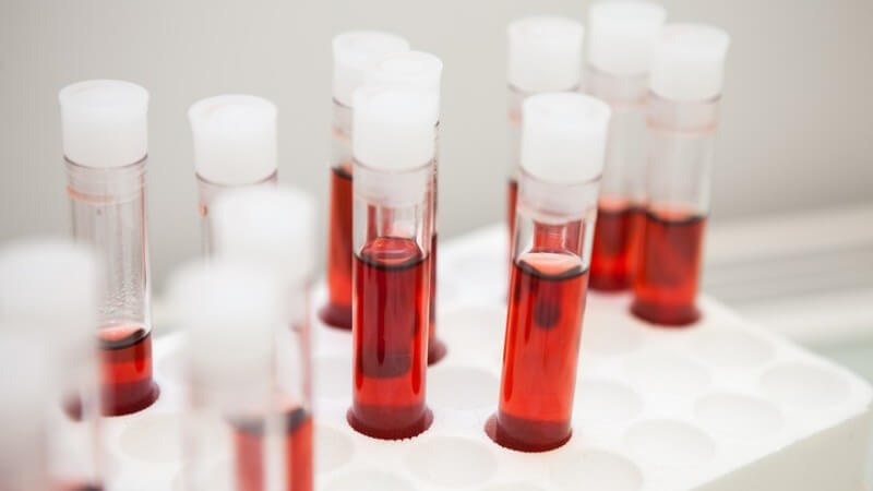 Ständer mit Reagenzgläsern mit Blutproben im Labor