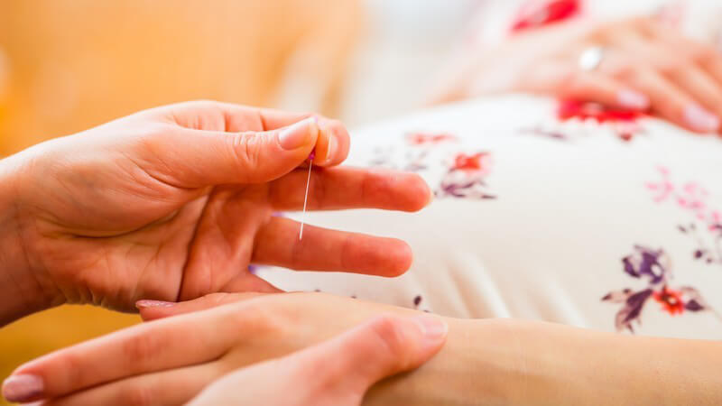 Schwangere erhält Akupunktur an der Hand