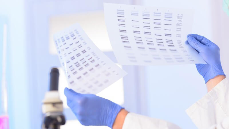 Forscher mit blauen Handschuhen hält in einem Labor zwei Zettel mit DNA-Mustern hoch