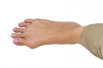 Nach Hallux valgus-Operation besser 6 Wochen lang kein Auto fahren