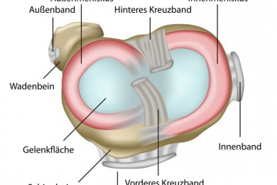 Besser für's Knie: Kreuzbandriss frühzeitig operieren lassen