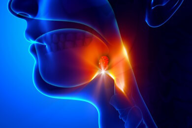 Probleme mit den Rachenmandeln: die Gaumenmandeln nicht gleichzeitig entfernen lassen