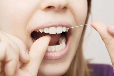 Ist der Einsatz von Zahnseide überflüssig?