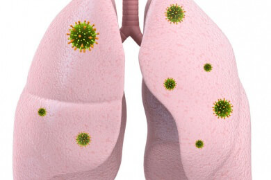 Der Dudelsack als Todesursache: Musiker infiziert sich mit Schimmelpilzen