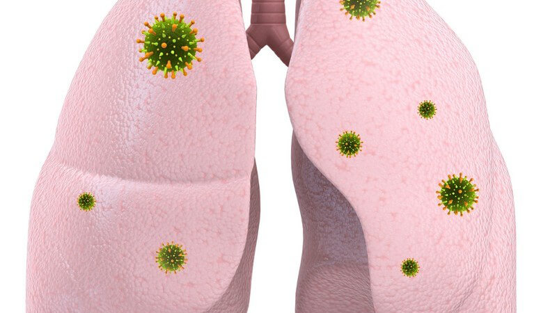 3D Grafik menschliche Lunge, Infektion auf weißem Hintergrund
