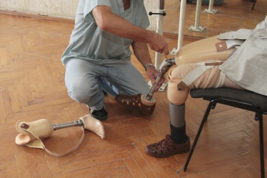 Der Joghurtbecher wird zur Prothese: Deutscher Forscher will Ersatzkörperteile für 10 Euro erstellen