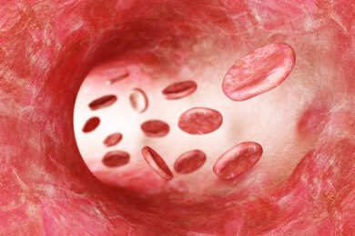 Studie vergleicht Bypass-Operation mit und ohne Herz-Lungenmaschine