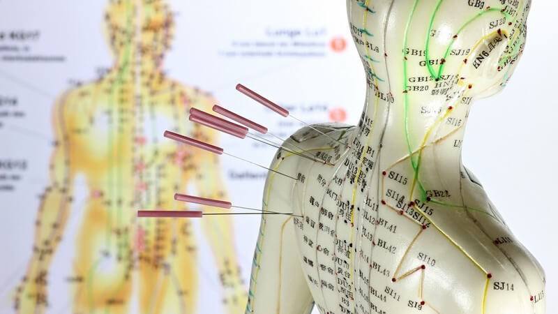 Akupunkturnadeln hängen in Modellpuppe mit aufgezeichneten Meridianpunkten, im Hintergrund auch als Poster