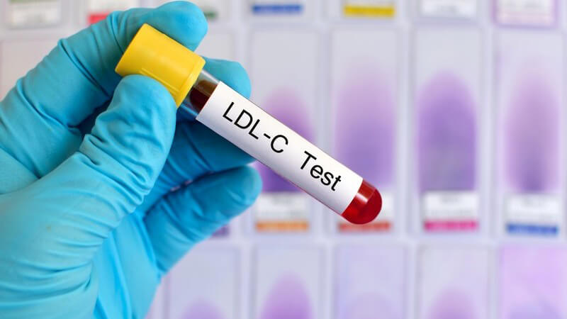Hand mit blauem Handschuh hält ein Röhrchen mit einer Blutprobe für einen LDL-Cholesterin-Test