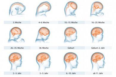 Infektion mit dem Zikavirus im Mutterleib: Hirnschäden sind nicht immer sofort sichtbar