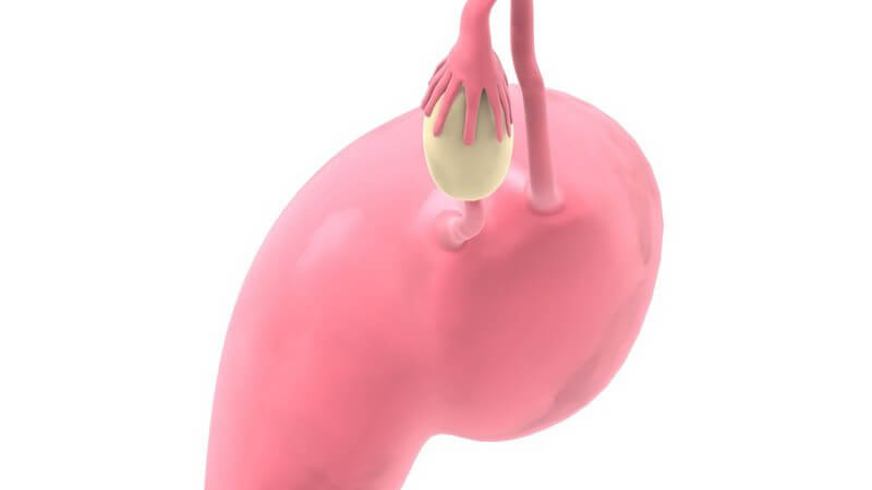 Grafische Darstellung weblicher Uterus