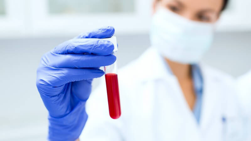Wissenschaftlerin mit Mundschutz und blauen Schutzhandschuhen hält ein Blutproben-Teströhrchen