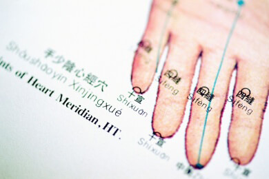 Kann das Karpaltunnelsyndrom durch Akupunktur behandelt werden?