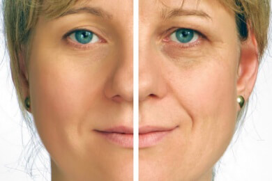 Wie wirkt Facelifting auf den Betrachter: jünger, attraktiver, erfolgreicher?