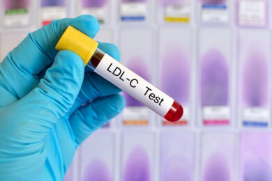 Im Kampf gegen LDL-Cholesterin: einfache Injektion könnte über Monate schützen