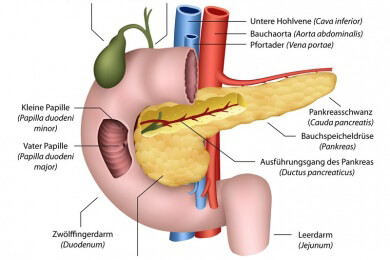 Säurebildende Lebensmittel födern Diabetes