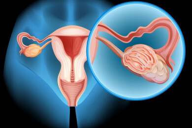 Künstliche Organe: Mäuse bekommen Nachwuchs mit Eierstöcken aus dem 3D-Drucker