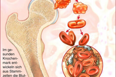 Künstliches Blut für die Forschung: Durchbruch bei der Herstellung von Blutstammzellen