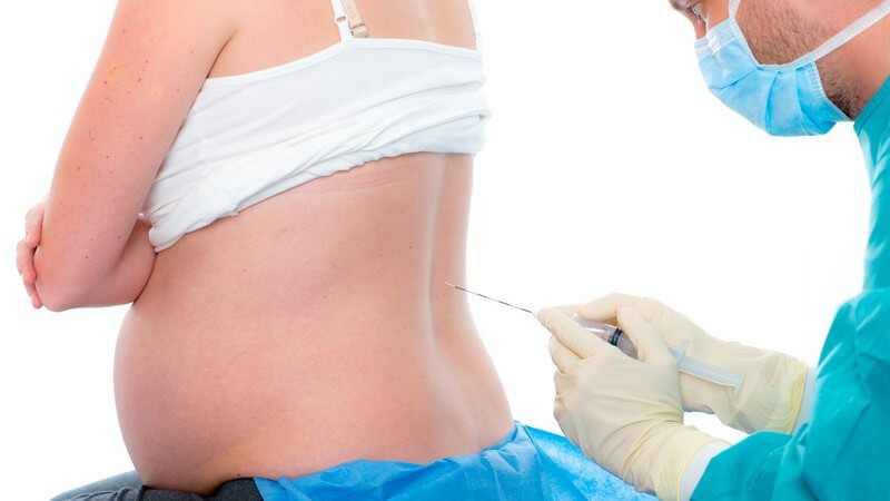 Arzt mit Mundschutz und OP-Kleidung führt eine Periduralanästhesie (PDA) bei einer schwangeren Frau durch