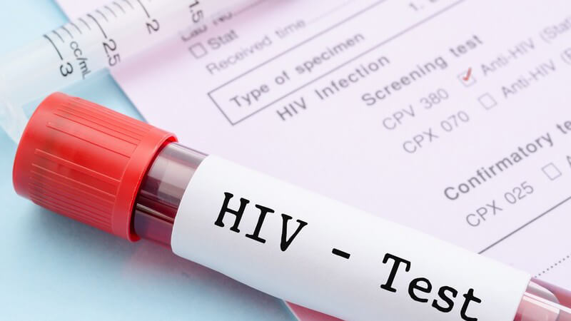 Blutprobe mit Aufschrift "HIV-Test" liegt neben leerer Spritze auf einem Formular