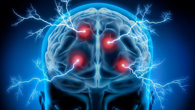 Blaue 3-D-Grafik eines Kopfes mit sichtbarem Gehirn und roten Punkten mit Blitzen (Geistesblitze)