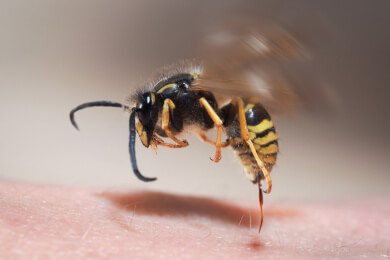 Gefährliche Apitherapie: "Bienen-Akupunktur" endet für Patientin tödlich